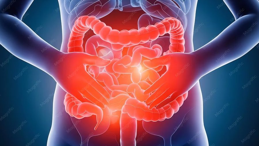 Gut inflammation