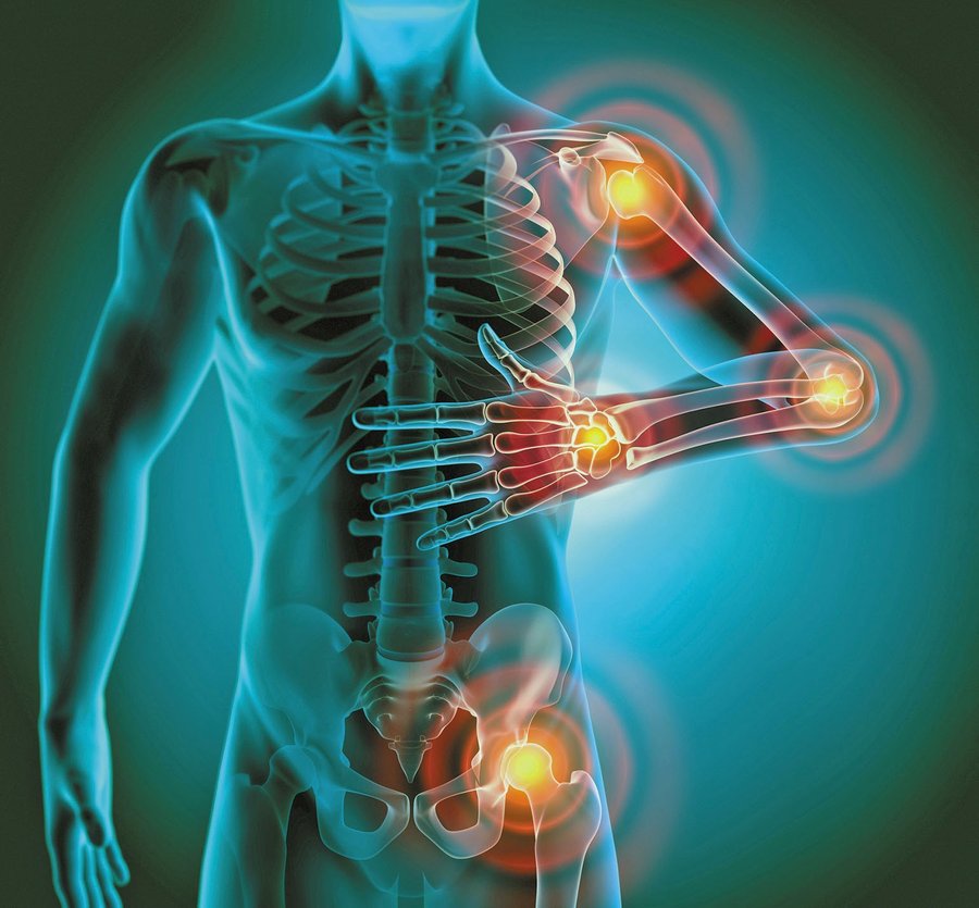 Chronic inflammation affects joints, tissue, and organs throughout the body